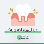 درمان-ورم-لثه-درمان-التهاب-لثه