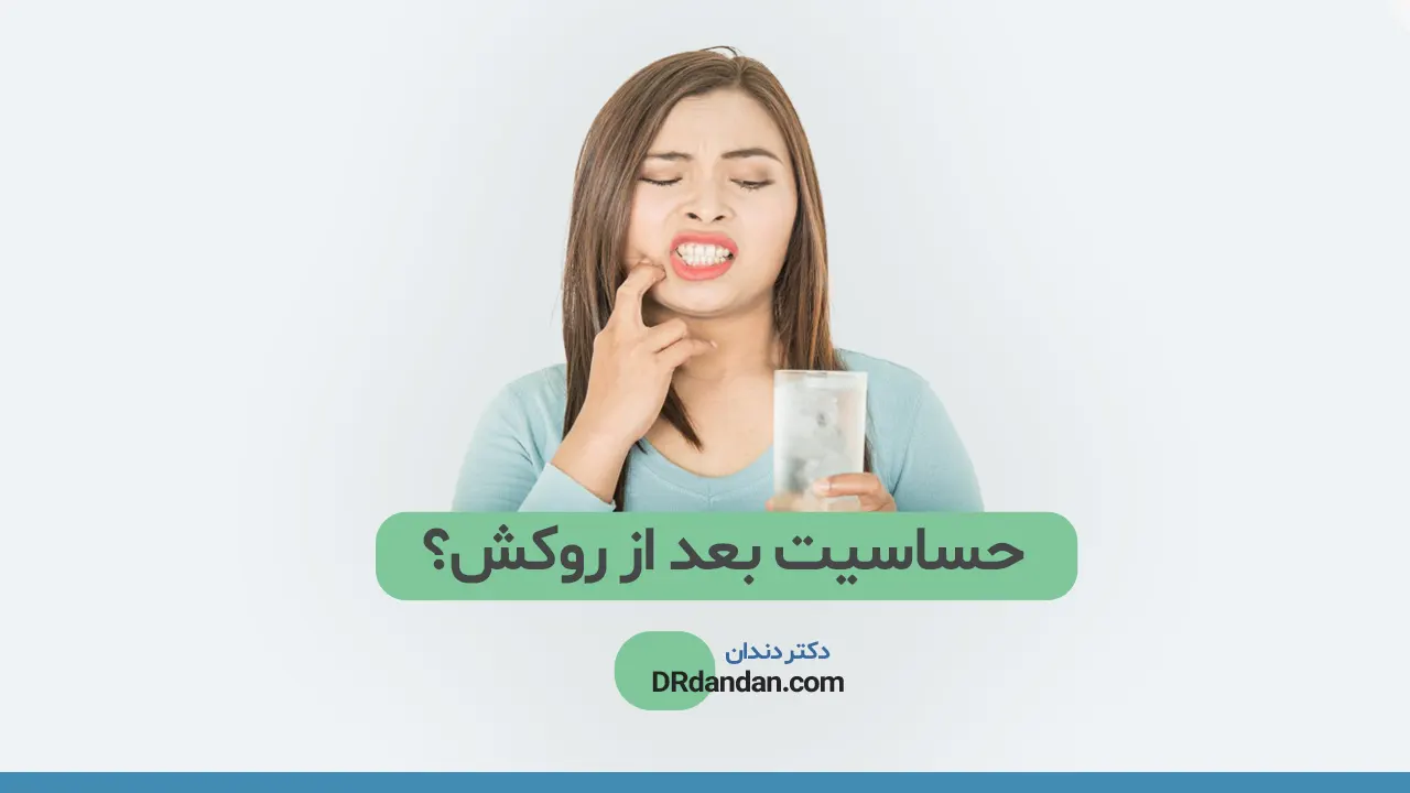 حساسیت دندان بعد از روکش