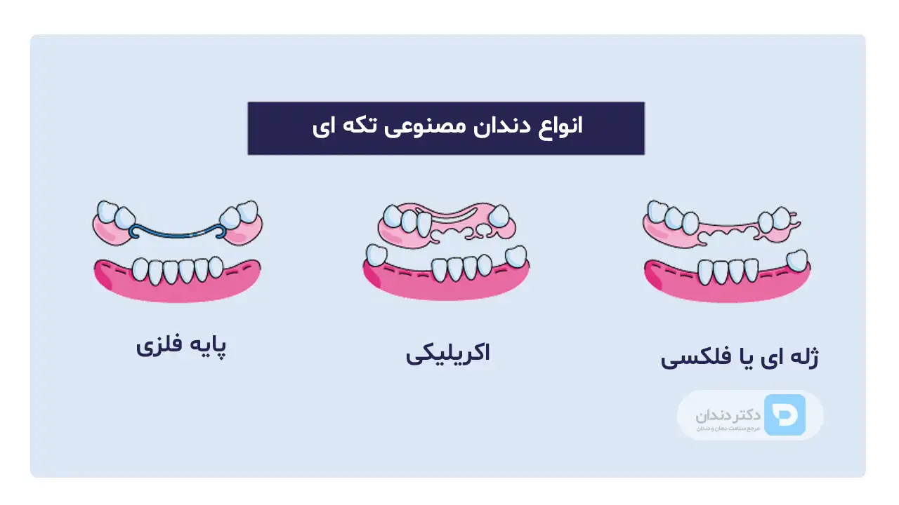 اینفوگرافی انواع دندان مصنوعی تکه ای