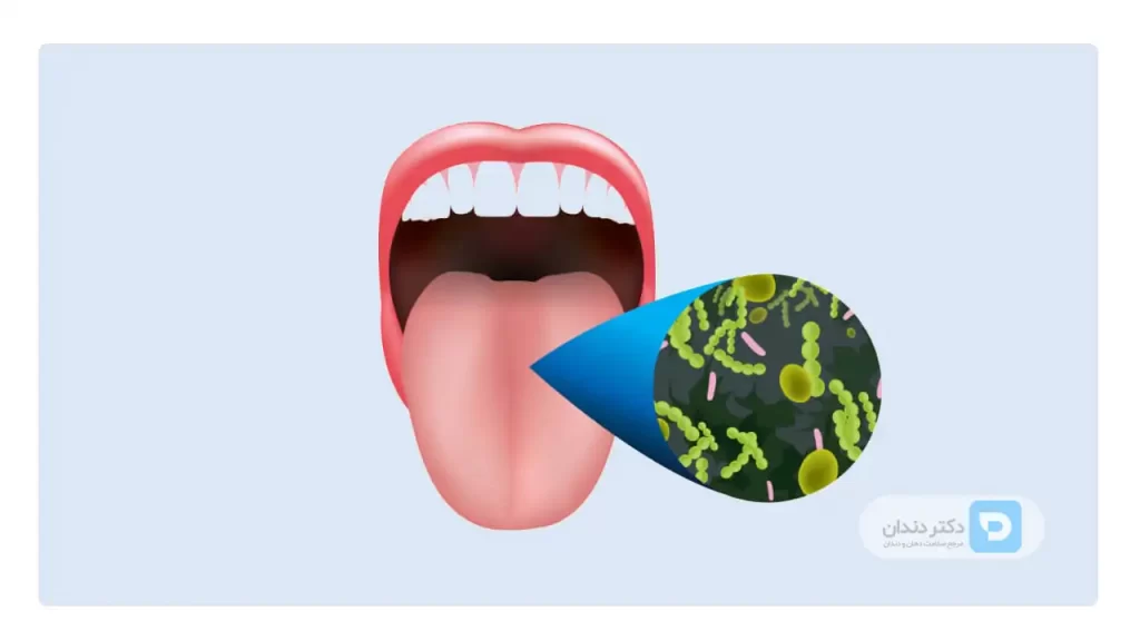 تصویر شماتیک باکتری های روی زبان و دهان