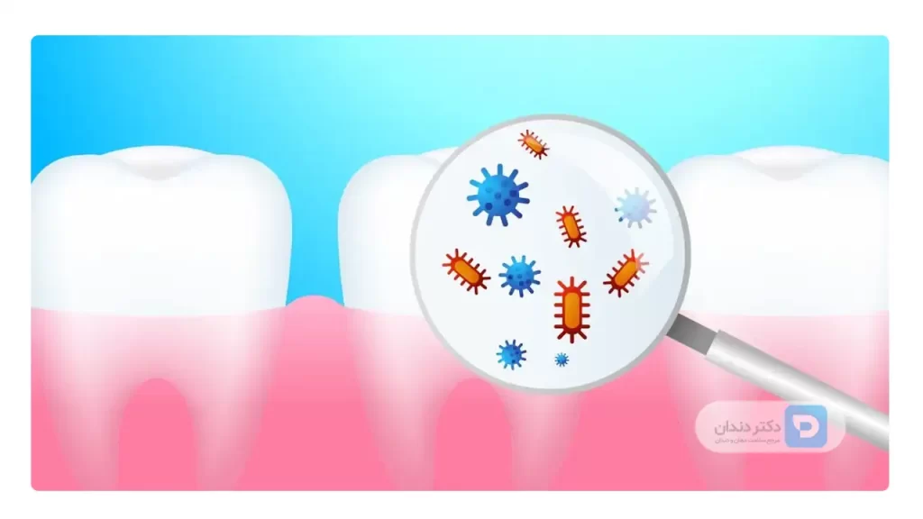 عکس شماتیک باکتری های دندانی که در به وجود آمدن پلاک و جرم دندان تاثیر گذار هستند