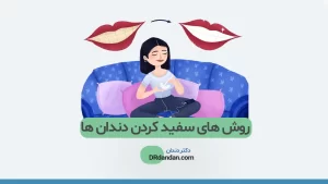 روش سفید کردن دندان ها