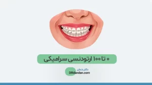 عکس ارتودنسی سرامیکی