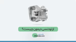عکس ارتودنسی دیمون