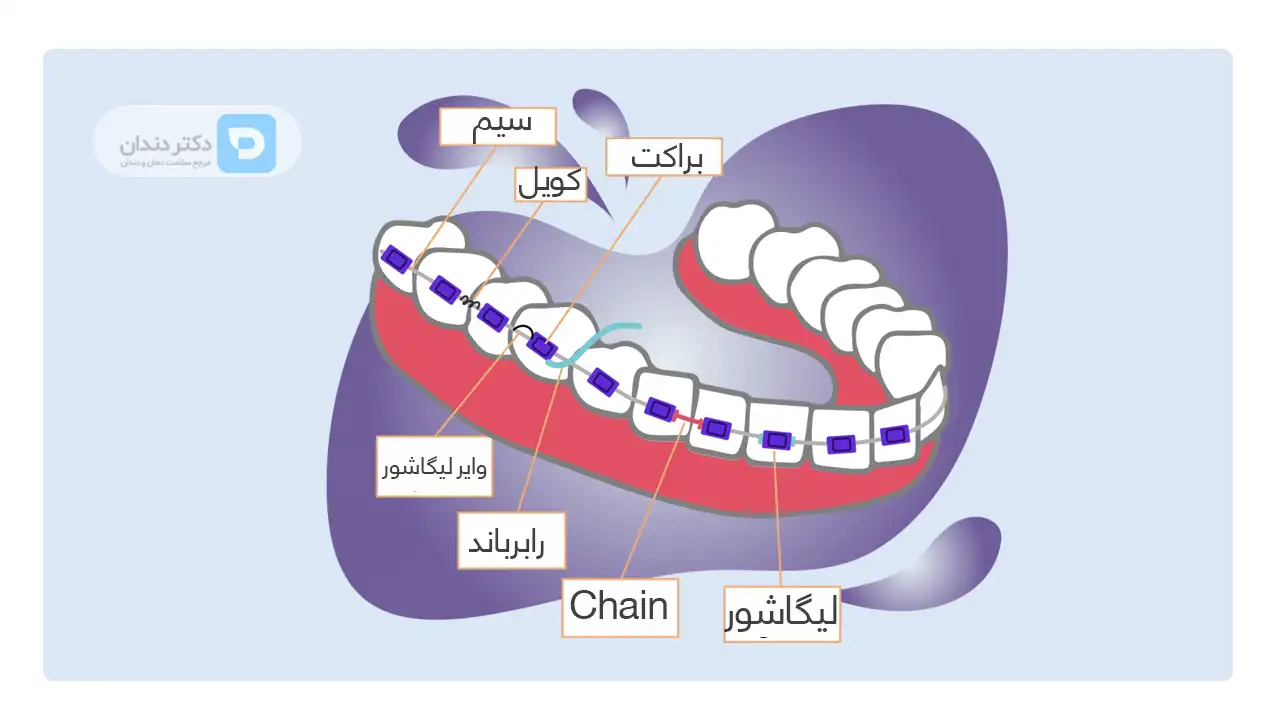 اینفوگرافی بخش های مختلف ارتودنسی 