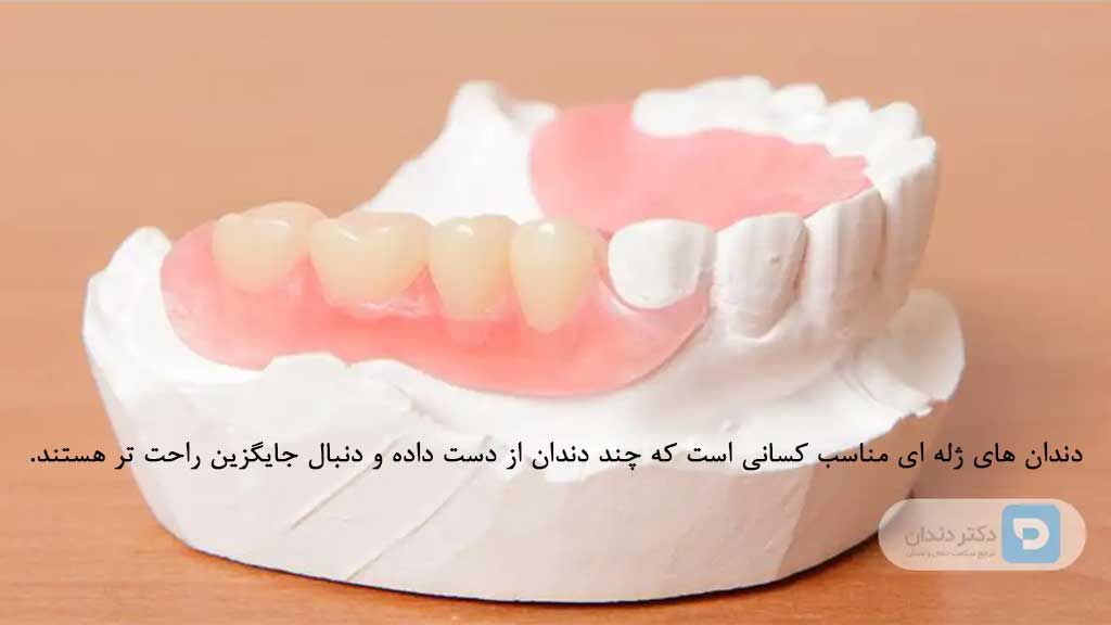 عکس دندان مصنوعی ژله ای آماده روی قالب دندان