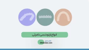 انواع ارتودنسی نامرئی