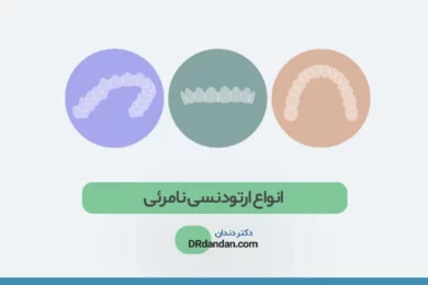 انواع ارتودنسی نامرئی