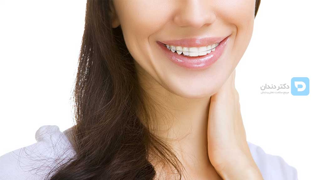 اثربخشی و محدودیتهای ارتودنسی متحرک