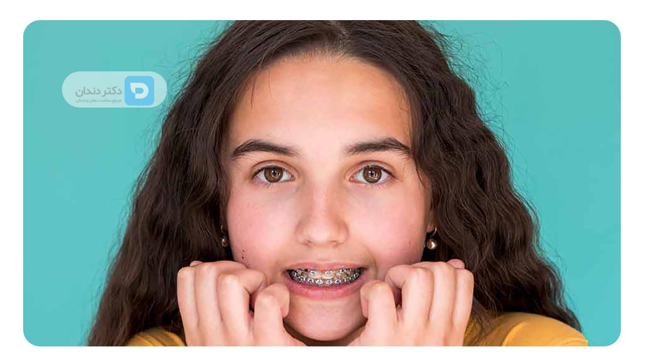 کشیدن دندان برای ارتودنسی و آسیب به چهره 