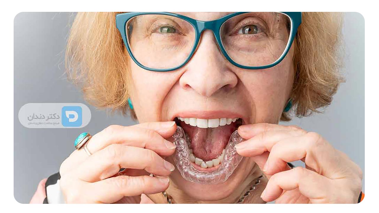 عوارض ارتودنسی در سنین بالا
