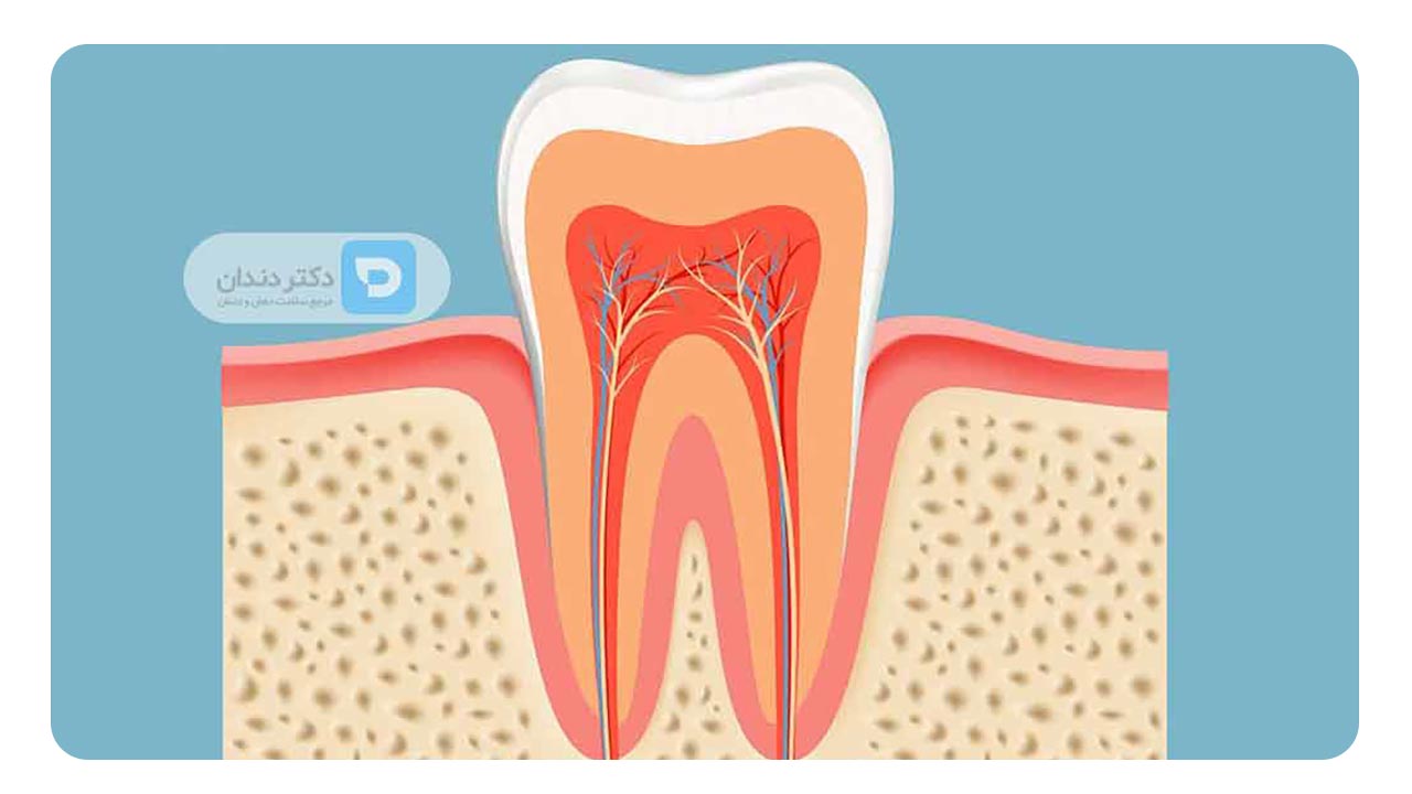 جوش خوردن ریشه دندان به استخوان فک