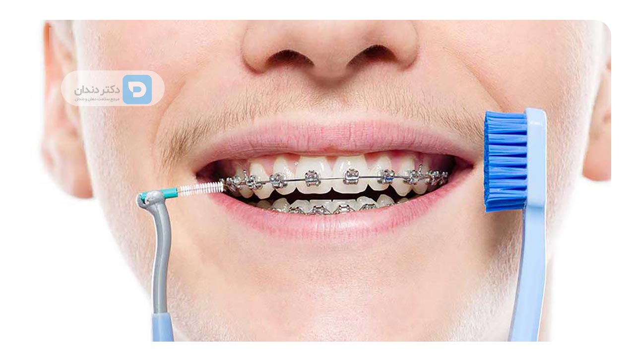  بهداشت دهان