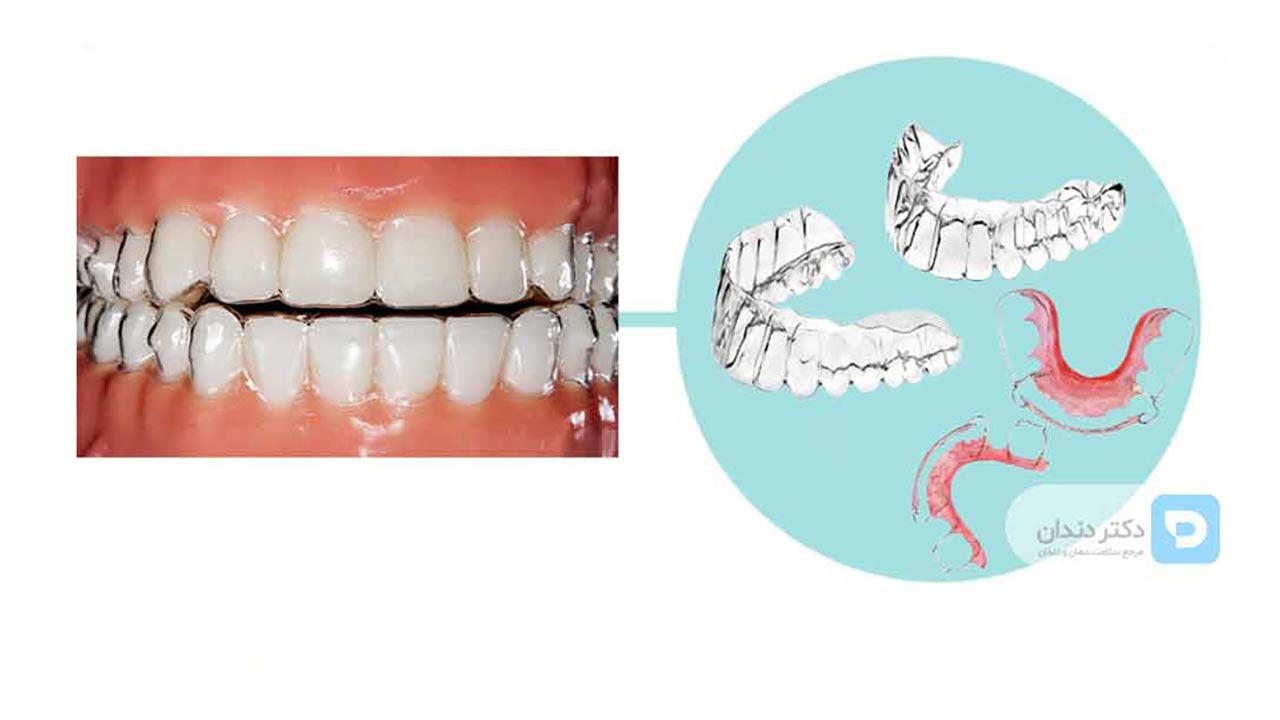 ارتودنسی متحرک چیست؟
