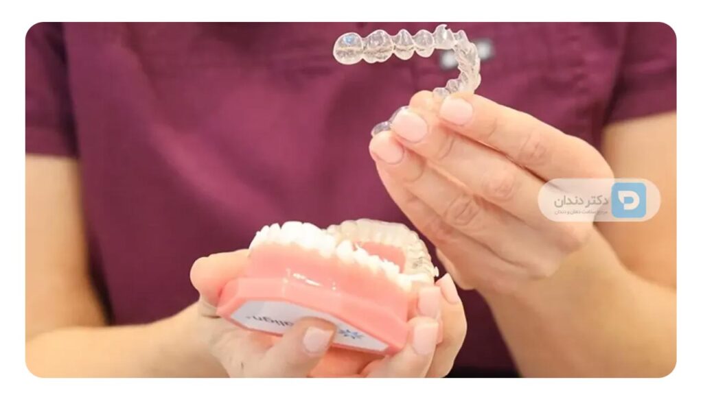 نگهدارنده ارتودنسی متحرک 
