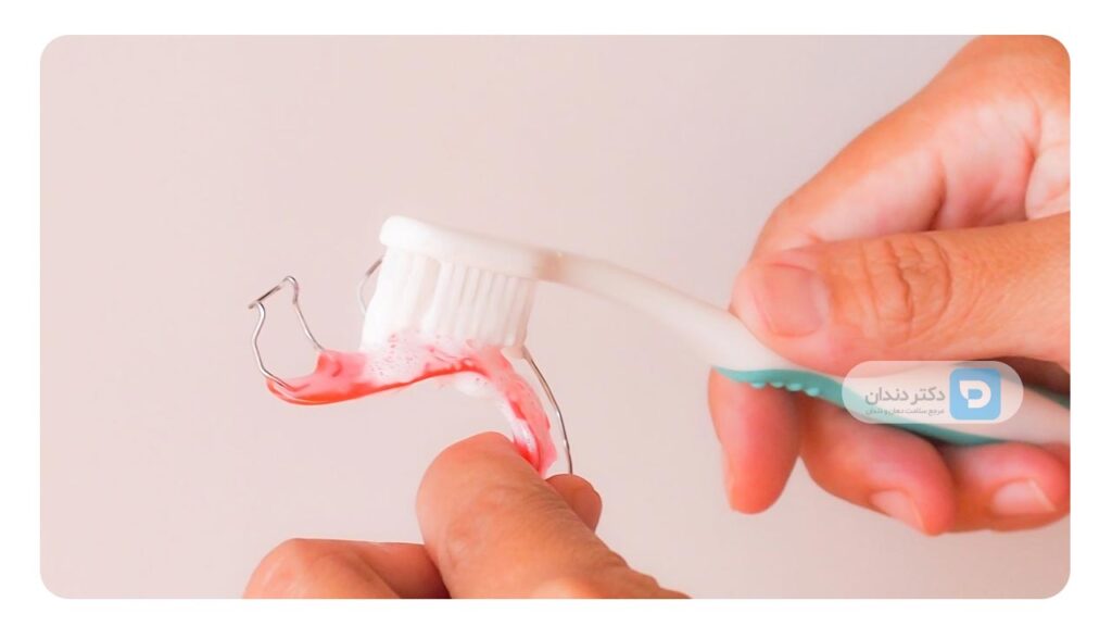 روش های تمیز کردن ارتودنسی متحرک