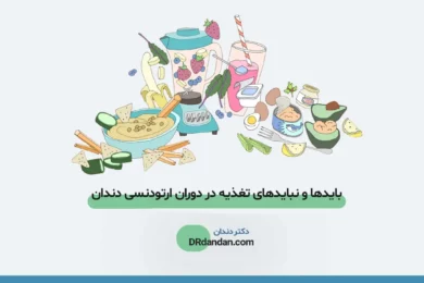 تغذیه در ارتودنسی دندان