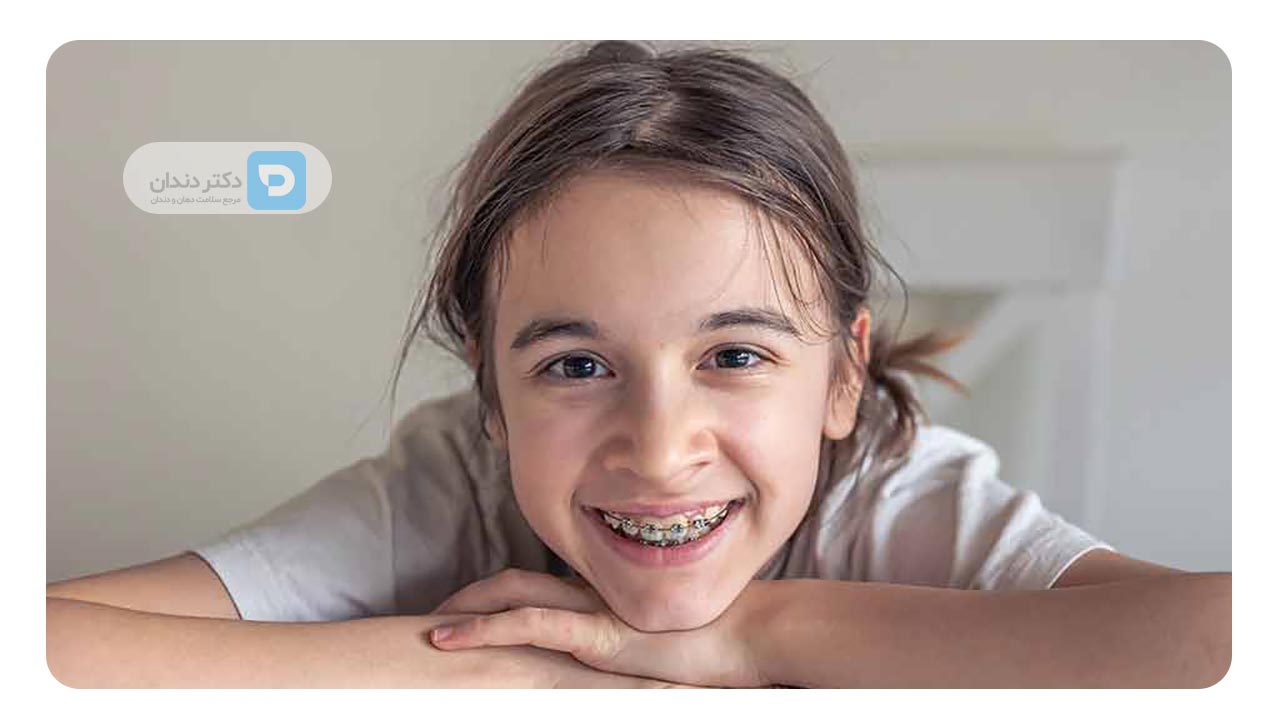 درمان های ارتودنسی را از کودکی شروع کنید