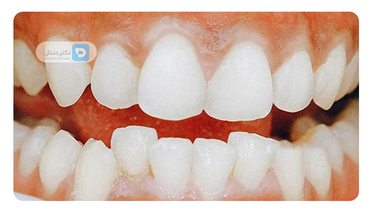 مدت زمان رفع نامرتبی های جزئی