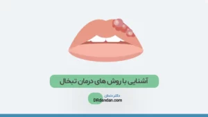 درمان تبخال لب
