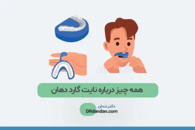 همه چیز درباره نایت گارد دهان