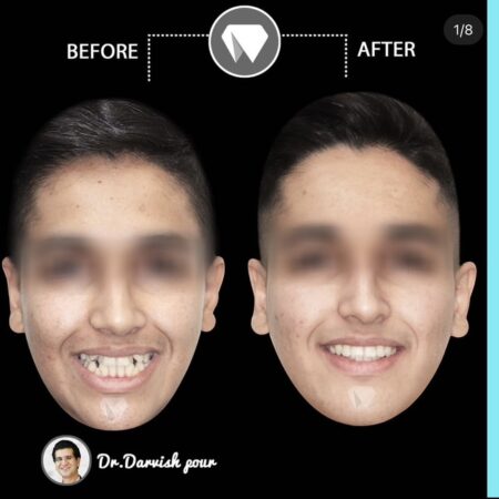 ارتودنسی ثابت