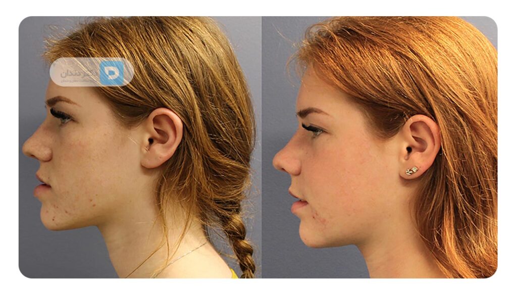 جراحی اصلاحی فک