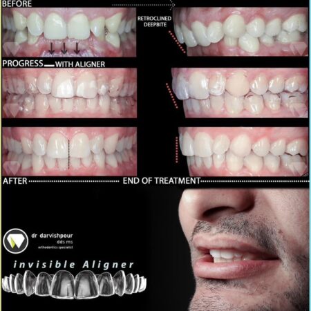 نمونه کار دکتر درویش پور