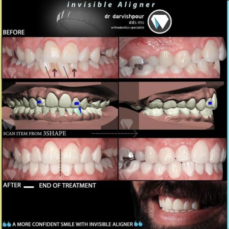 نمونه کار دکتر درویش پور