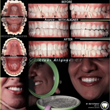 نمونه کار دکتر درویش پور
