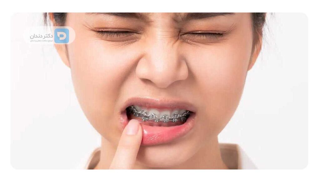 انواع درد ارتودنسی